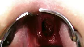 ش الشاب أكل جوي hand ...